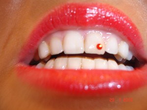 Balti zobiņi